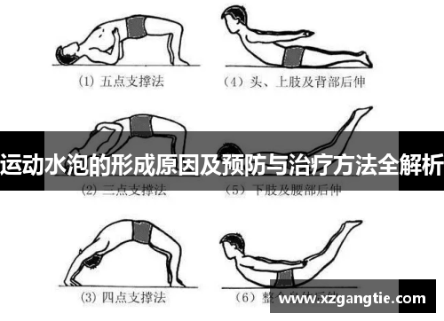 运动水泡的形成原因及预防与治疗方法全解析